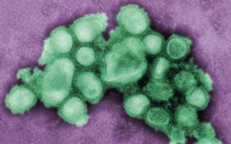 Click to enlarge swine flu natural defence