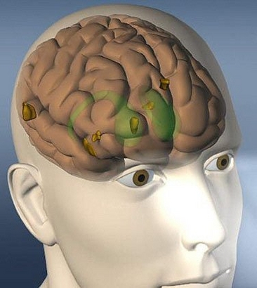 image of brain