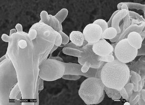 The new Cryptococcus gatti fungus strain