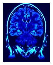 Click to enlarge Brain