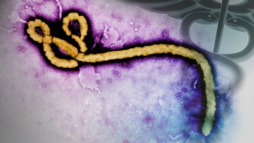 ebola