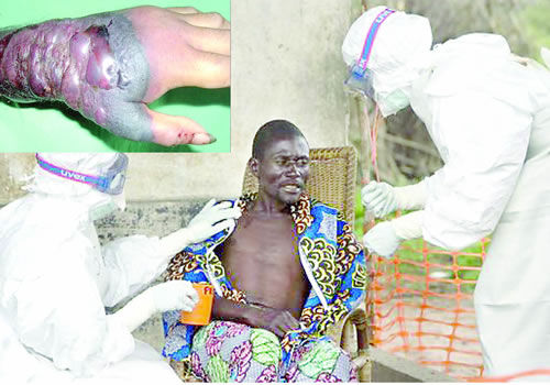 nigeria ebola