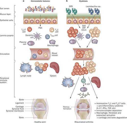 Click to enlarge microbiome and autoimmunity