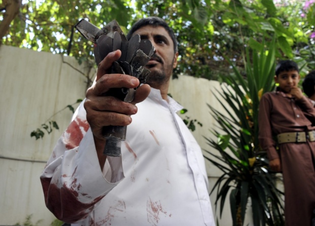 A Yemeni man with rocket remains