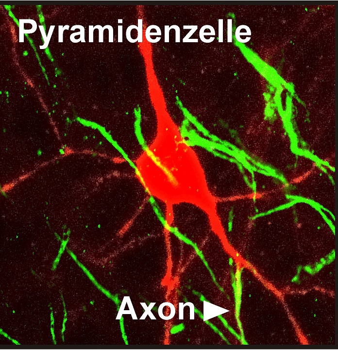 Click to enlarge New Type of Brain Cell