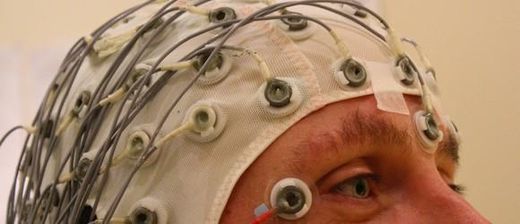 Brain monitoring
