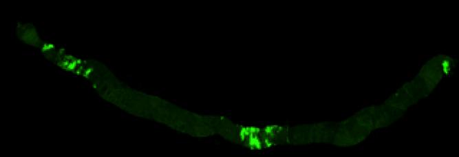 Click to enlarge Tumor Growth 2