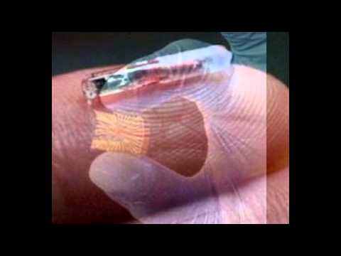 implant