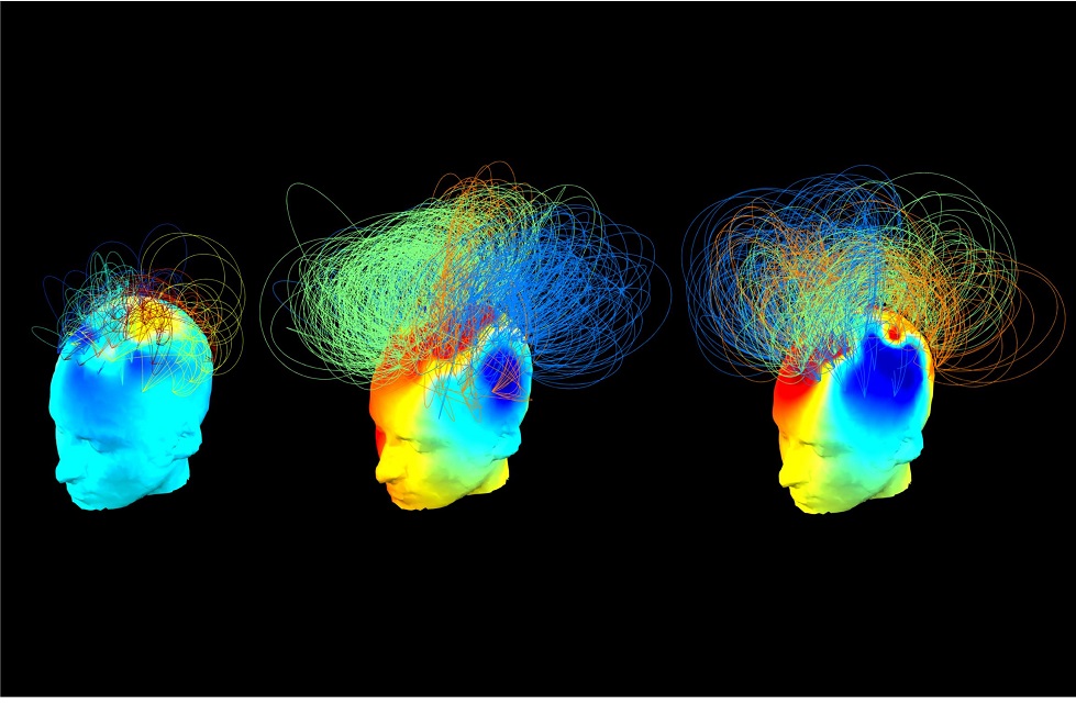 Brain Networks