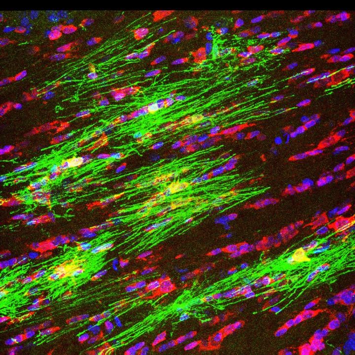 myelin