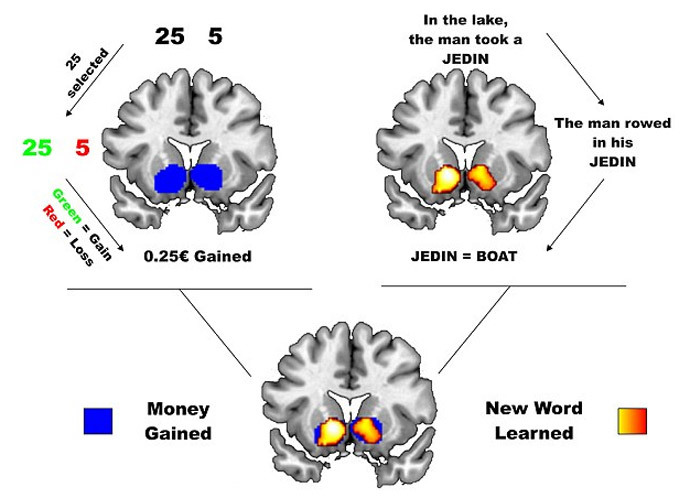 Click to enlarge Brain