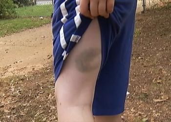 child abuse georgia administrator