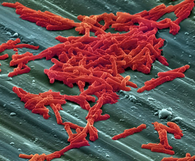 Click to enlarge C. Difficile