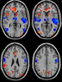 brain images pain pathways