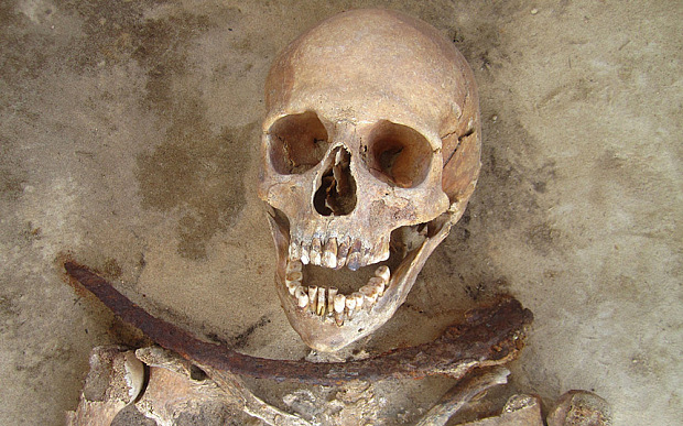 Cholera Victim