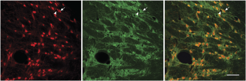 neural connections