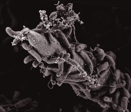 Click to enlarge bacteria