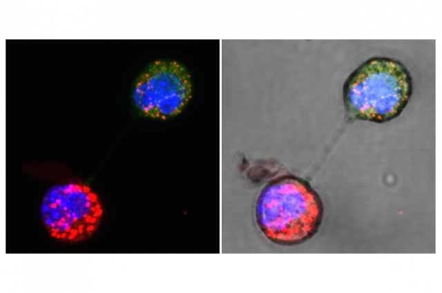 Click to enlarge DNA transfer tumour cells