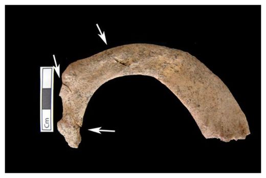 Click to enlarge Bone