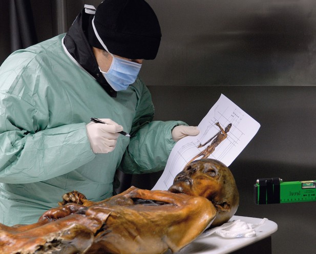 Click to enlarge Otzi