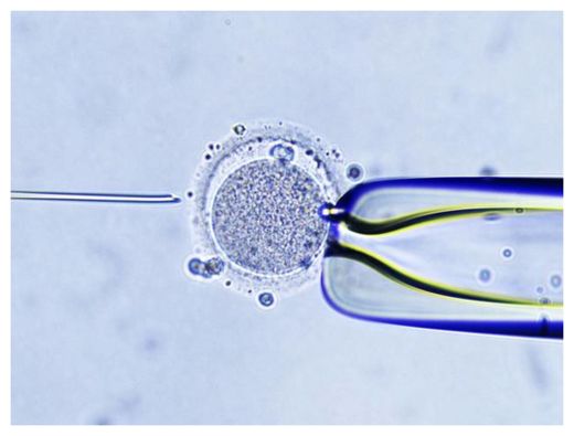IVF Treatment