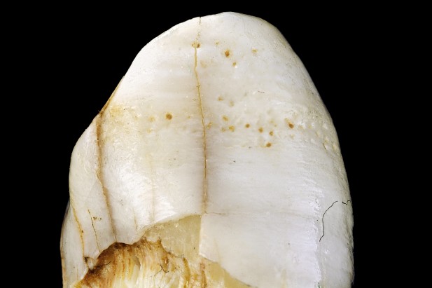 Click to enlarge Neanderthal tooth