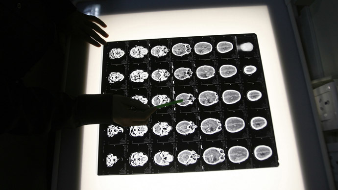 brain scan