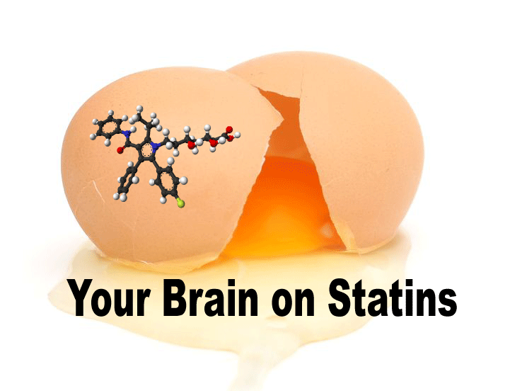 Click to enlarge statin brain