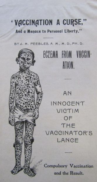 Click to enlarge vaccination eczema