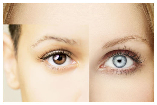 Click to enlarge Brown to Blue Eyes