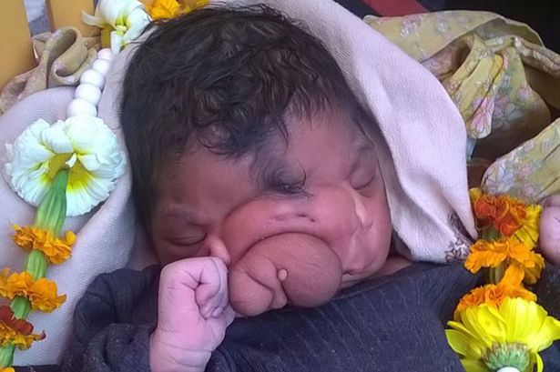 Click to enlarge baby with elephant trunk