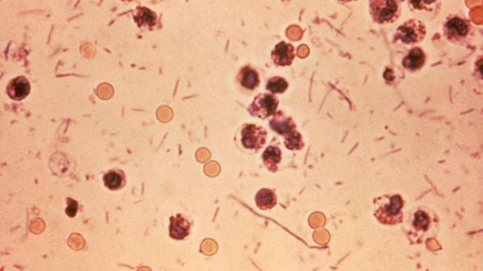 Shigella stool