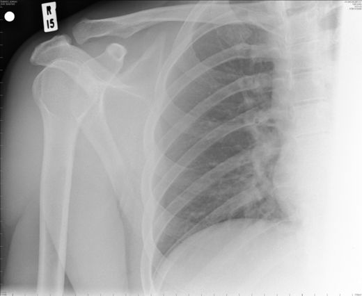xray