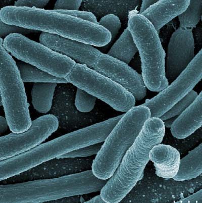 Click to enlarge Darmbakterien der Art Escherichia coli