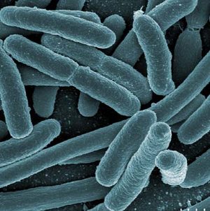 Darmbakterien der Art Escherichia coli
