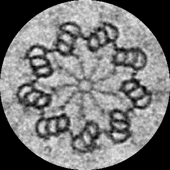 An electron micrograph of a centriole