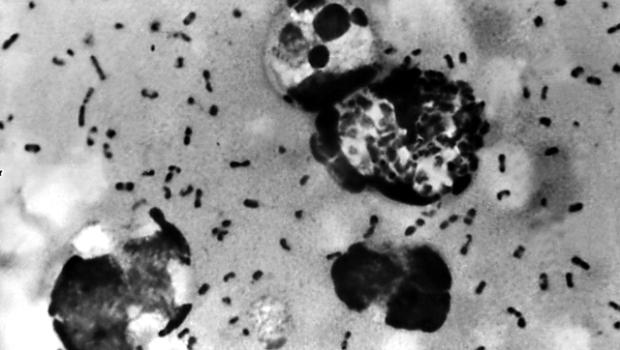 pneumonic plague