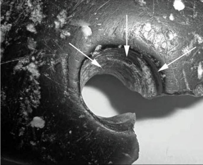 Click to enlarge The Denisovan bracelet_3