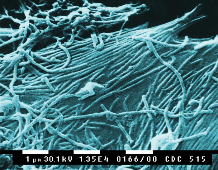 Click to enlarge Ebola-Virus