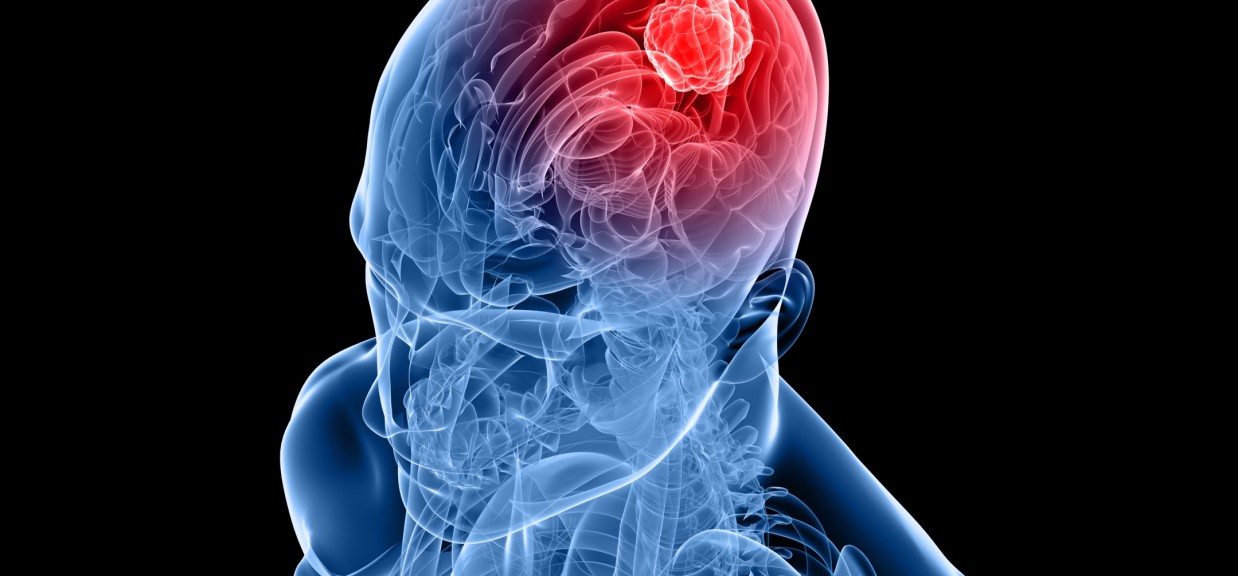 brain health