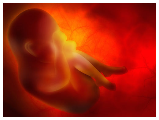 Foetus