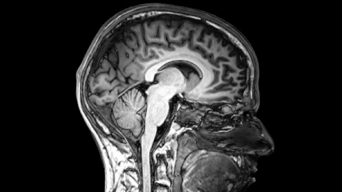 human brain mapping