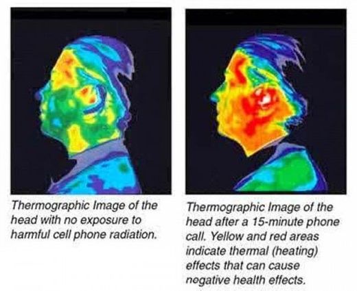 Click to enlarge thermographic heads