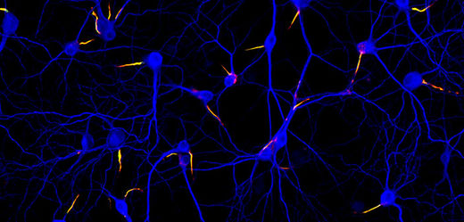 epigenetic mechanism, brain cells