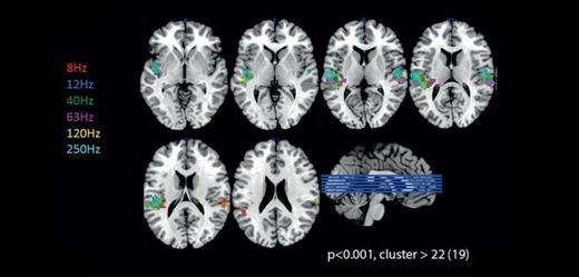 Click to enlarge brain scans audible hearing