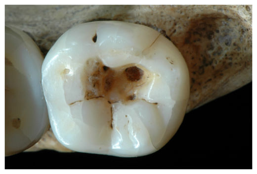 Click to enlarge Molar