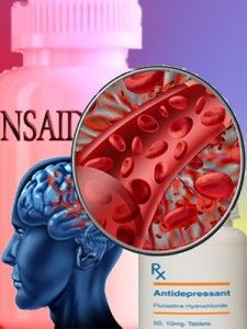 nsaid antidepressant brain bleed
