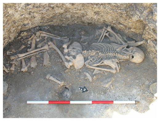 Click to enlarge Female Skeleton