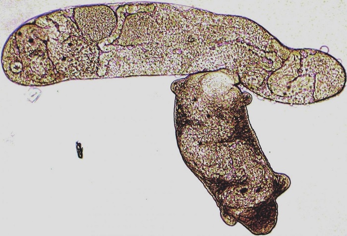 Click to enlarge flatworm parasite