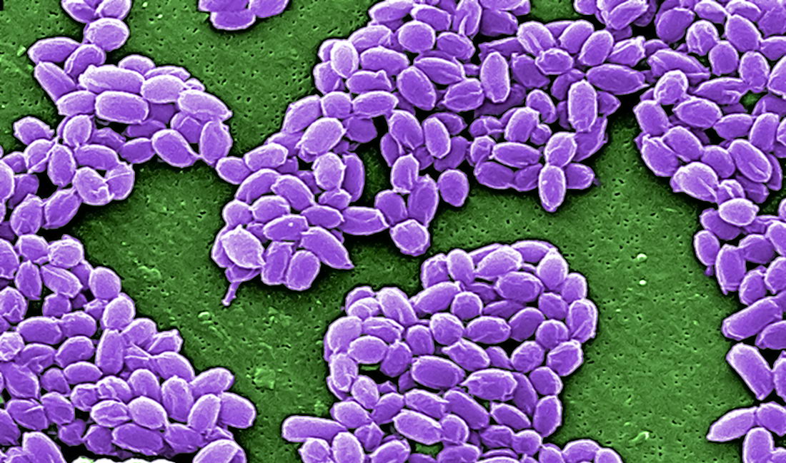 Spores anthrax